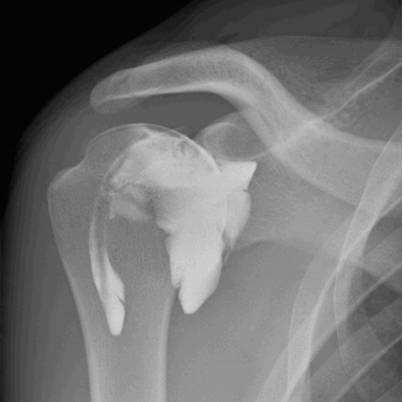 Radiographie